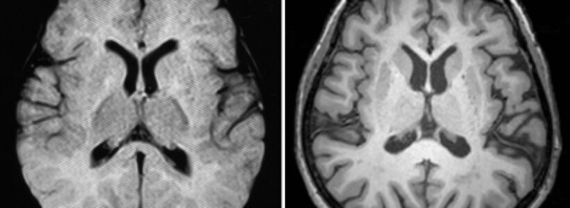 cerebro_como_esponjas6uyyujg76