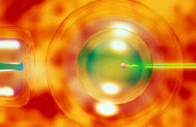 in_vitro4566788967