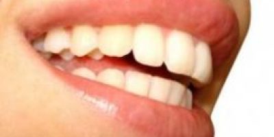 sonrisa-_Naturalmente_con_alimentos