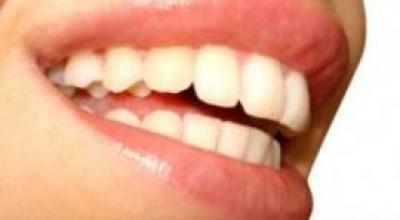 sonrisa-_Naturalmente_con_alimentos