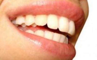 sonrisa-_Naturalmente_con_alimentos