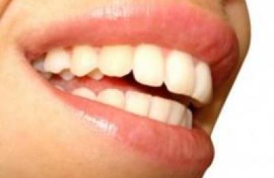 sonrisa-_Naturalmente_con_alimentos