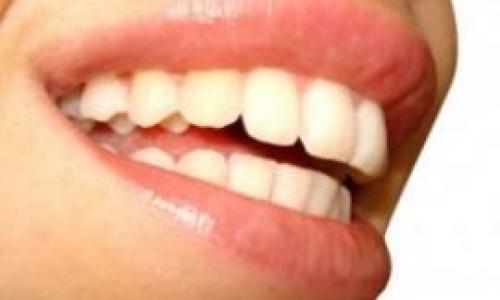 sonrisa-_Naturalmente_con_alimentos