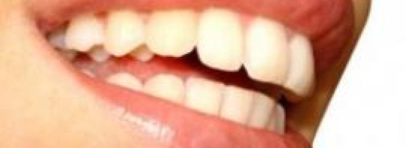 sonrisa-_Naturalmente_con_alimentos