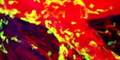 Un-infarto-300x173