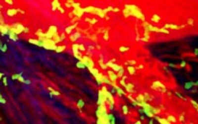 Un-infarto-300x173