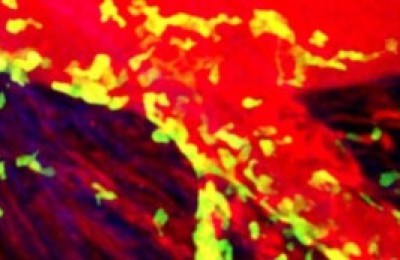 Un-infarto-300x173