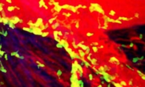 Un-infarto-300x173