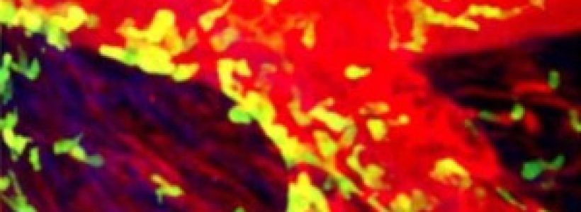 Un-infarto-300x173