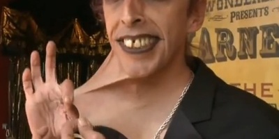 hombre_con_la_piel_mas_elastica