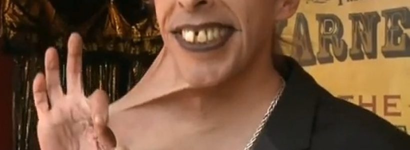 hombre_con_la_piel_mas_elastica