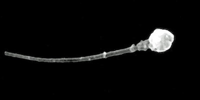 Imagen_microscopica_de_un_espermatozoide_-__Universidad_de_Utah