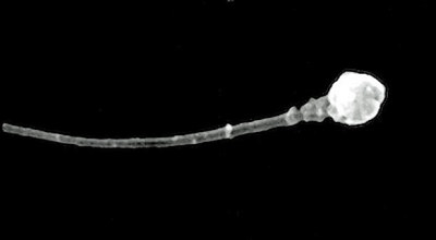 Imagen_microscopica_de_un_espermatozoide_-__Universidad_de_Utah