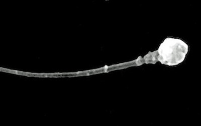 Imagen_microscopica_de_un_espermatozoide_-__Universidad_de_Utah