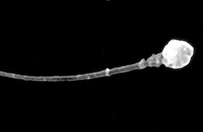 Imagen_microscopica_de_un_espermatozoide_-__Universidad_de_Utah