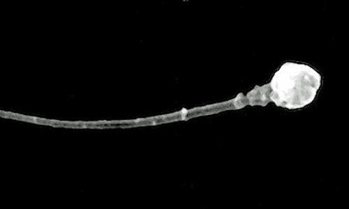 Imagen_microscopica_de_un_espermatozoide_-__Universidad_de_Utah