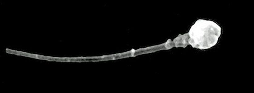 Imagen_microscopica_de_un_espermatozoide_-__Universidad_de_Utah