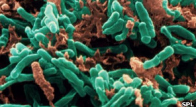 tuberculosis97786744657