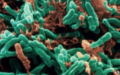 tuberculosis97786744657