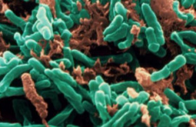 tuberculosis97786744657