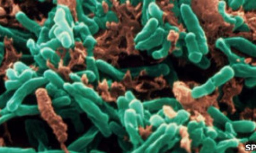 tuberculosis97786744657