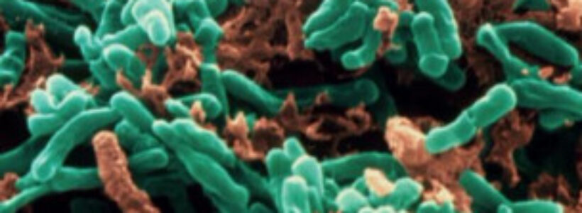 tuberculosis97786744657
