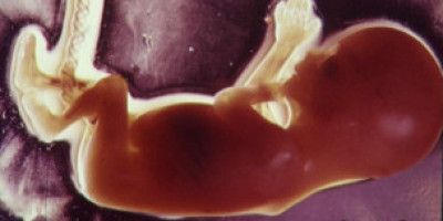 120124091356_baby_embryo_304x171_camerapress