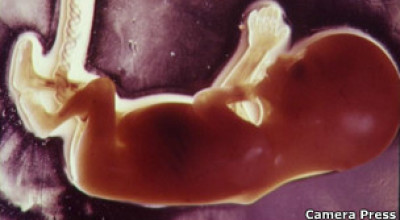 120124091356_baby_embryo_304x171_camerapress