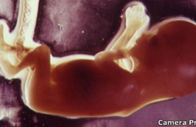 120124091356_baby_embryo_304x171_camerapress