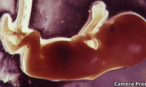 120124091356_baby_embryo_304x171_camerapress