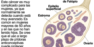 cancer-de-ovario