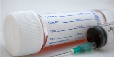 120501122202_blood_test_304x171_bbc_nocredit