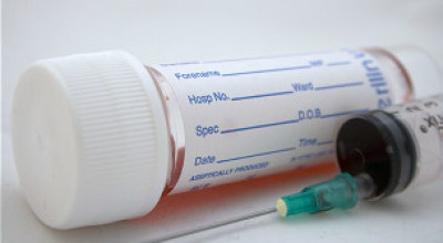 120501122202_blood_test_304x171_bbc_nocredit