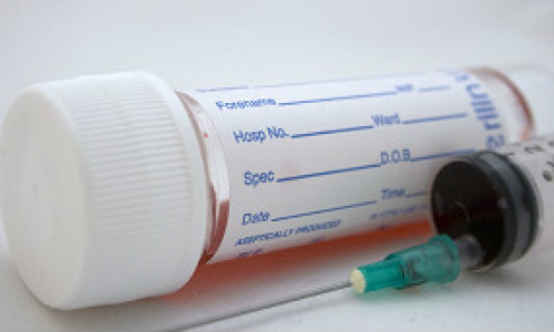 120501122202_blood_test_304x171_bbc_nocredit
