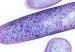 121026103927_cdifficile_304x171_spl_nocredit