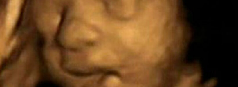 121122104354_feto_304x171__nocredit