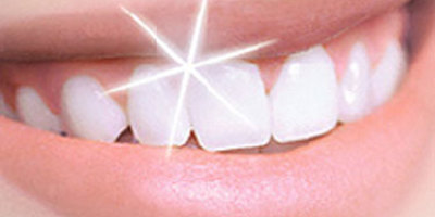 dientes_mas-blancos