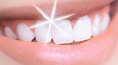 dientes_mas-blancos