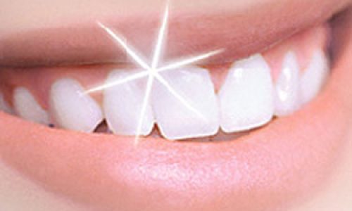 dientes_mas-blancos