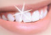 dientes_mas-blancos