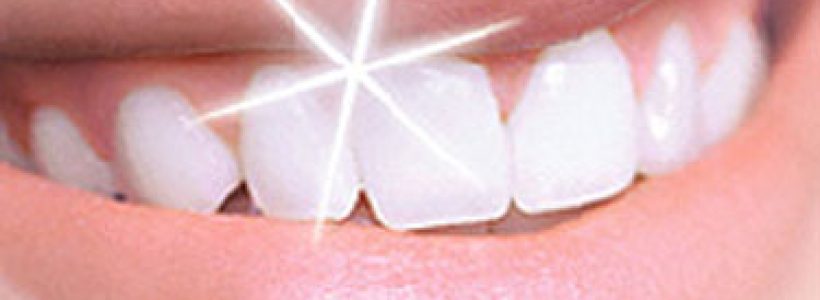 dientes_mas-blancos