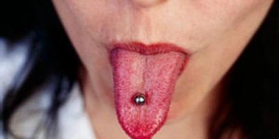 Los-balines-magnticos-pueden-ingerirse-accidentalmente-y-causar-perforacin-gstrica.-300x168