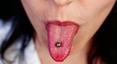 Los-balines-magnticos-pueden-ingerirse-accidentalmente-y-causar-perforacin-gstrica.-300x168