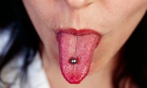 Los-balines-magnticos-pueden-ingerirse-accidentalmente-y-causar-perforacin-gstrica.-300x168