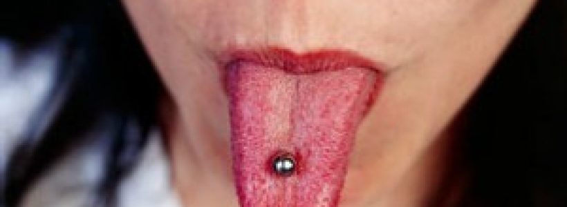 Los-balines-magnticos-pueden-ingerirse-accidentalmente-y-causar-perforacin-gstrica.-300x168