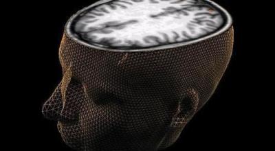cerebro35678974532