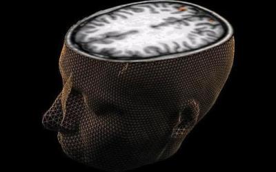 cerebro35678974532