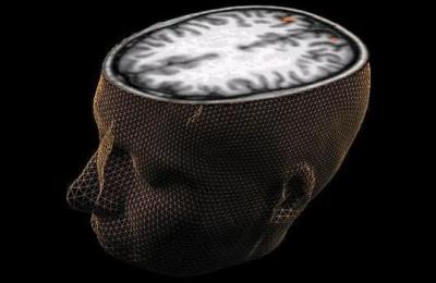 cerebro35678974532