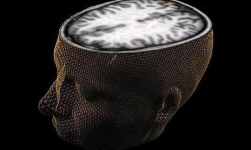cerebro35678974532