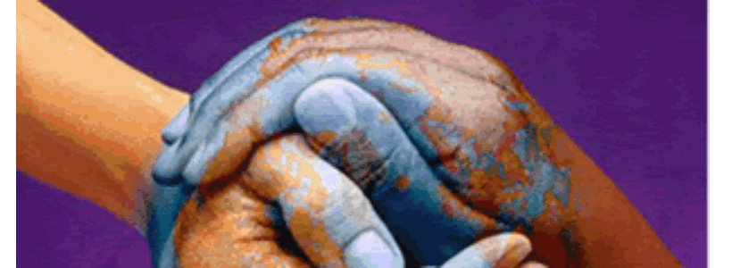 derechos_humanos435669576